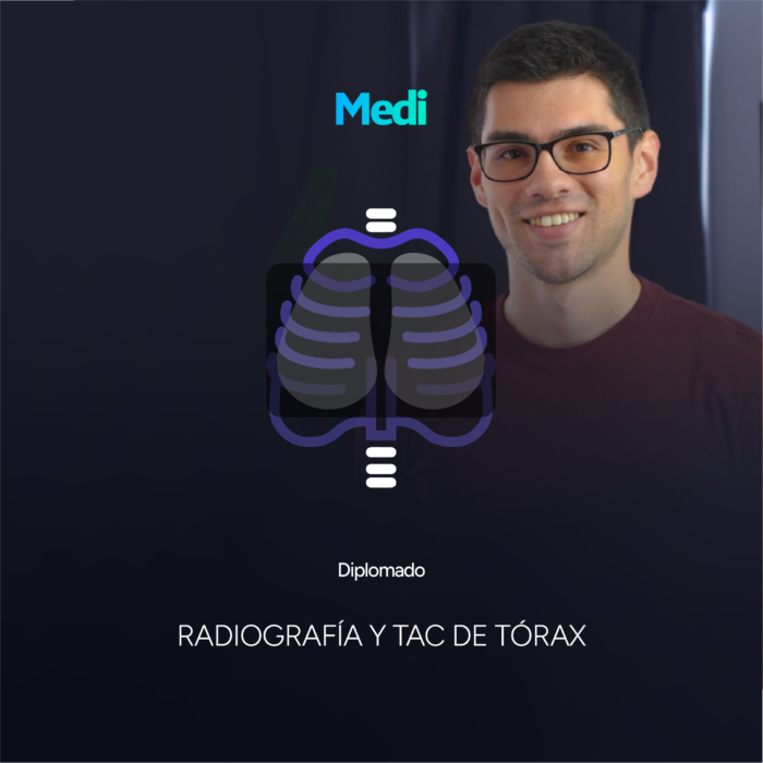 Diplomado en Radiografía de Torax